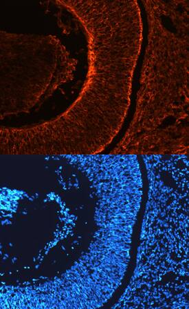 Nogo-B was detected in immersion fixed frozen sections of mouse embryonic retina (E13.5) using Sheep Anti-Mouse Nogo-B Antigen Affinity-purified Polyclonal Antibody (Catalog # AF6596) at 10 µg/mL overnight at 4 °C. Tissue was stained using the NorthernLights™ 557-conjugated Anti-Sheep IgG Secondary Antibody (red, upper panel; Catalog # NL010) and counterstained with DAPI (blue, lower panel). Specific staining was localized to retina. View our protocol for Fluorescent IHC Staining of Frozen Tissue Sections.