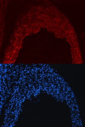 Nogo-B was detected in immersion fixed frozen sections of adult mouse heart using Mouse Nogo-B Monoclonal Antibody (Catalog # MAB6596) at 10 µg/mL overnight at 4 °C. Tissue was stained using the NorthernLights™ 557-conjugated Anti-Rat IgG Secondary Antibody (red, upper panel; Catalog # NL013) and counterstained with DAPI (blue, lower panel). Specific staining was localized to cardiac outflow tract. View our protocol for Fluorescent IHC Staining of Frozen Tissue Sections.
