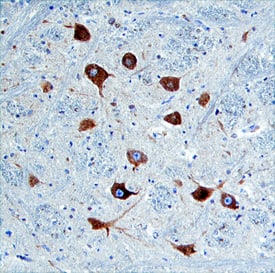 Nogo-C was detected in immersion fixed paraffin-embedded sections of human brain (medulla) using Human Nogo-C Antigen Affinity-purified Polyclonal Antibody (Catalog # AF5766) at 10 µg/mL overnight at 4 °C. Tissue was stained using the Anti-Sheep HRP-DAB Cell & Tissue Staining Kit (brown; Catalog # CTS019) and counterstained with hematoxylin (blue). Specific staining was localized to cytoplasm. View our protocol for Chromogenic IHC Staining of Paraffin-embedded Tissue Sections.
