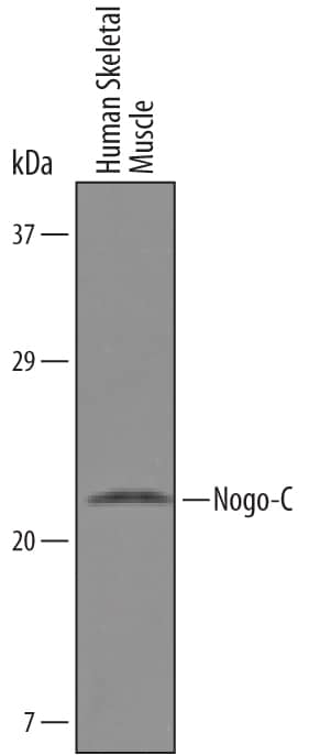 Western blot shows lysates of human skeletal muscle. PVDF Membrane was probed with 1 µg/mL of Human Nogo-C Antigen Affinity-purified Polyclonal Antibody (Catalog # AF5766) followed by HRP-conjugated Anti-Sheep IgG Secondary Antibody (Catalog # HAF016). A specific band was detected for Nogo-C at approximately 22 kDa (as indicated). This experiment was conducted under reducing conditions and using Immunoblot Buffer Group 1.
