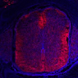 Nogo-A was detected in immersion fixed frozen sections of rat embryo (E18) using Mouse Anti-Rat Nogo-A Monoclonal Antibody (Catalog # MAB3098) at 10 µg/mL overnight at 4 °C. Tissue was stained using the NorthernLights™ 557-conjugated Anti-Mouse IgG Secondary Antibody (red; Catalog # NL007) and counterstained with DAPI (blue). Specific staining was localized to spinal cord and dorsal root ganglia. View our protocol for Fluorescent IHC Staining of Frozen Tissue Sections.