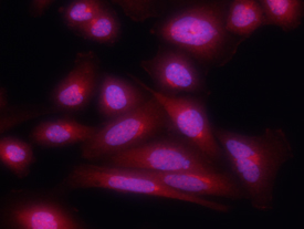 Notch-1 was detected in immersion fixed Saos-2 human osteosarcoma cell line using 10 µg/mL Sheep Anti-Human Notch-1 Intracellular Domain Antigen Affinity-purified Polyclonal Antibody (Catalog # AF3647) for 3 hours at room temperature. Cells were stained with the NorthernLights™ 557-conjugated Anti-Sheep IgG Secondary Antibody (red; Catalog # NL010) and counterstained with DAPI (blue). View our protocol for Fluorescent ICC Staining of Cells on Coverslips.