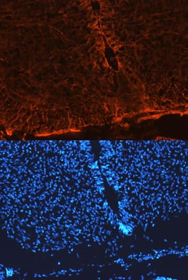 Notch-1 was detected in immersion fixed frozen sections of mouse neural tube (E13.5) using Mouse Notch-1 Antigen Affinity-purified Polyclonal Antibody (Catalog # AF5267) at 10 µg/mL overnight at 4 °C. Tissue was stained using the NorthernLights™ 557-conjugated Anti-Sheep IgG Secondary Antibody (red, upper panel; Catalog # NL010) and counterstained with DAPI (blue, lower panel). View our protocol for Fluorescent IHC Staining of Frozen Tissue Sections.