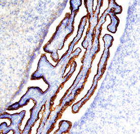 Notch‑2 was detected in perfusion fixed frozen sections of rat brain (choroid plexus) using 5 &micro;g/mL Goat Anti-Rat Notch‑2 Antigen Affinity-purified Polyclonal Antibody (Catalog # AF1190) overnight at 4 &deg;C. Tissue was stained with the Anti-Goat HRP-DAB Cell & Tissue Staining Kit (brown; Catalog # CTS008) and counterstained with hematoxylin (blue). View our protocol for Chromogenic IHC Staining of Frozen Tissue Sections.