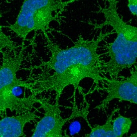 Immunocytochemistry Notch-1 Antibody [Unconjugated]