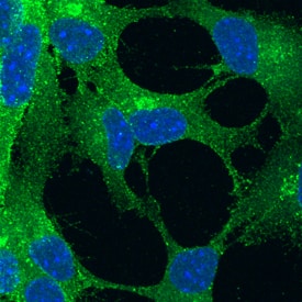 Immunocytochemistry Notch-1 Antibody [Unconjugated]
