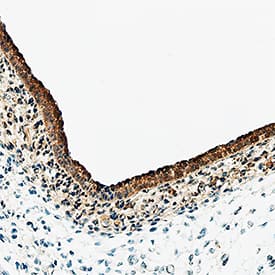 Immunohistochemistry Notch-1 Antibody [Unconjugated]