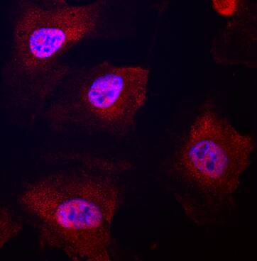 Notch-4 was detected in immersion fixed HUVEC human umbilical vein endothelial cells using Rat Anti-Human Notch-4 Intracellular Domain Monoclonal Antibody (Catalog # MAB3847) at 10 µg/mL for 3 hours at room temperature. Cells were stained using the NorthernLights™ 557-conjugated Anti-Rat IgG Secondary Antibody (red; Catalog # NL013) and counterstained with DAPI (blue). Specific staining was localized to nuclei and cytoplasm. View our protocol for Fluorescent ICC Staining of Cells on Coverslips.