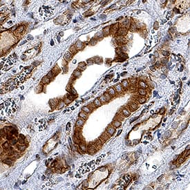 Nox4 was detected in immersion fixed paraffin-embedded sections of human kidney using Mouse Anti-Human Nox4 Monoclonal Antibody (Catalog # MAB8158) at 1.7 µg/mL for 1 hour at room temperature followed by incubation with the Anti-Mouse IgG VisUCyte™ HRP Polymer Antibody (Catalog # VC001). Before incubation with the primary antibody, tissue was subjected to heat-induced epitope retrieval using Antigen Retrieval Reagent-Basic (Catalog # CTS013). Tissue was stained using DAB (brown) and counterstained with hematoxylin (blue). Specific staining was localized to cytoplasm and nuclei. View our protocol for IHC Staining with VisUCyte HRP Polymer Detection Reagents.