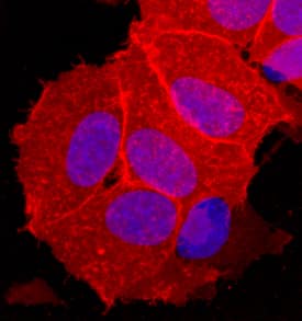 Immunocytochemistry OBCAM/OPCML Antibody [Unconjugated]