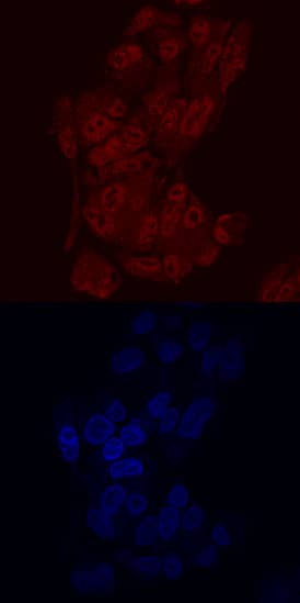 Immunocytochemistry ONECUT2/OC-2 Antibody [Unconjugated]