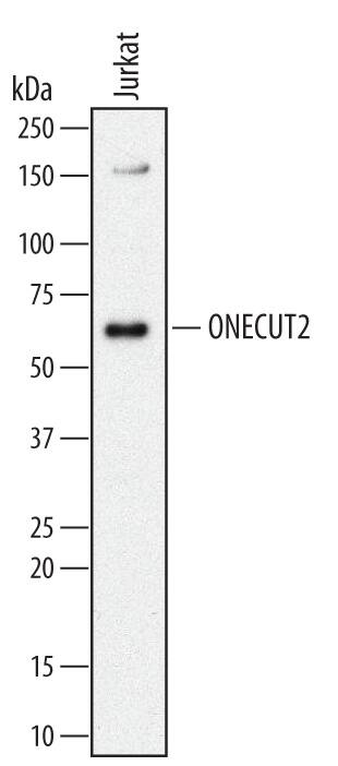 Western blot shows lysates of Jurkat human acute T cell leukemia cell line. PVDF Membrane was probed with 2 µg/mL of Mouse Anti-Human ONECUT2 Monoclonal Antibody (Catalog # MAB6294) followed by HRP-conjugated Anti-Mouse IgG Secondary Antibody (Catalog # HAF007). A specific band was detected for ONECUT2 at approximately 60 kDa (as indicated). This experiment was conducted under reducing conditions and using Immunoblot Buffer Group 1.