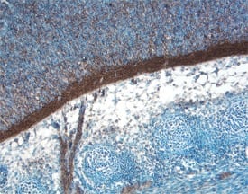 Oncostatin M/OSM was detected in immersion fixed frozen sections of mouse embryo (15 d.p.c, section through spinal cord) using Mouse Oncostatin M/OSM Antigen Affinity-purified Polyclonal Antibody (Catalog # AF-495-NA) at 15 µg/mL overnight at 4 °C. Tissue was stained using the Anti-Goat HRP-DAB Cell & Tissue Staining Kit (brown; Catalog # CTS008) and counterstained with hematoxylin (blue). View our protocol for Chromogenic IHC Staining of Frozen Tissue Sections.