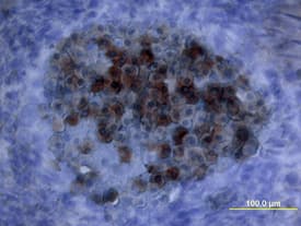 Oncostatin M/OSM was detected in immersion fixed frozen sections of mouse embryo using Mouse Oncostatin M/OSM Antigen Affinity-purified Polyclonal Antibody (Catalog # AF-495-NA) at 15 µg/mL overnight at 4 °C. Tissue was stained using the Anti-Goat HRP-DAB Cell & Tissue Staining Kit (brown; Catalog # CTS008) and counterstained with hematoxylin (blue). View our protocol for Chromogenic IHC Staining of Frozen Tissue Sections.