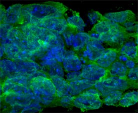 OSM R beta  was detected in immersion fixed D3 mouse embryonic stem cell line using Rat Anti-Mouse OSM R beta  Monoclonal Antibody (Catalog # MAB662) at 10 µg/mL for 3 hours at room temperature. Cells were stained using the NorthernLights™ 493-conjugated Anti-Rat IgG Secondary Antibody (green; Catalog # NL015) and counterstained with DAPI (blue). Specific staining was localized to cytoplasm and plasma membrane. View our protocol for Fluorescent ICC Staining of Cells on Coverslips.