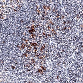 Immunohistochemistry OX40/TNFRSF4 Antibody [Unconjugated]