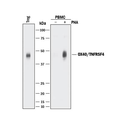 Western blot shows lysates of human T regulatory cells (Tregs) and human peripheral blood mononuclear cells (PBMCs) untreated (-) or treated (+) with 1 µg/mL PHA for 5 days. PVDF membrane was probed with 0.5 µg/mL of Sheep Anti-Human OX40/TNFRSF4 Antigen Affinity-purified Polyclonal Antibody (Catalog # AF3388) followed by HRP-conjugated Anti-Sheep IgG Secondary Antibody (Catalog # HAF016). A specific band was detected for OX40/TNFRSF4 at approximately 45 kDa (as indicated). This experiment was conducted under reducing conditions and using Immunoblot Buffer Group 1.