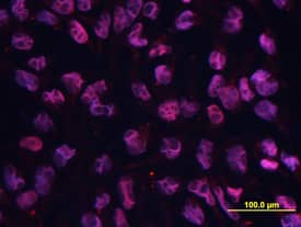 Oct‑3/4 was detected in immersion fixed BG01V human embryonic stem cells using Rat Anti-Human/Mouse Oct‑3/4 Monoclonal Antibody (Catalog # MAB1759) at 10 µg/mL for 3 hours at room temperature. Cells were stained using Rhodamine Red-coupled anti-rat IgG (red) and counterstained with DAPI (blue). Specific staining was localized to nuclei. View our protocol for Fluorescent ICC Staining of Cells on Coverslips.