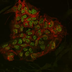 Oct-4A and E-Cadherin were detected in human BG01V embryonic stem cells grown on irradiated MEF cells using 10 µg/mL Human Oct-4A Monoclonal Antibody (Catalog # MAB17591) and 10 µg/mL Human E-Cadherin Affinity-purified Polyclonal Antibody (AF648). Cells were incubated with primary antibodies for 3 hours at room temperature. Cells were stained for Oct-4A using the Northern-Lights™ 493-conjugated Anti-Mouse IgG Secondary Antibody (green; NL009), and stained for E-Cadherin using the Northern-Lights™ 557-conjugated Anti-Goat IgG Secondary Antibody (red; NL001). Specific staining of Oct-4A was localized to nuclei. View our protocol for Fluorescent ICC Staining of Cells on Coverslips.