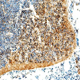Immunohistochemistry Olig2 Antibody [Unconjugated]