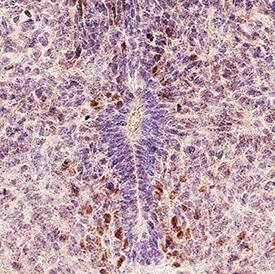 Olig3 was detected in immersion fixed frozen sections of 13 dpc mouse embryo tissue using Mouse Anti-Human/Mouse Olig3 Monoclonal Antibody (Catalog # MAB24561) at 5 µg/mL for 1 hour at room temperature followed by incubation with the Anti-Mouse IgG VisUCyte™ HRP Polymer Antibody (Catalog # VC001). Before incubation with the primary antibody, tissue was subjected to heat-induced epitope retrieval using Antigen Retrieval Reagent-Basic (Catalog # CTS013). Tissue was stained using DAB (brown) and counterstained with hematoxylin (blue). Specific staining was localized to cell nuclei. View our protocol for IHC Staining with VisUCyte HRP Polymer Detection Reagents.