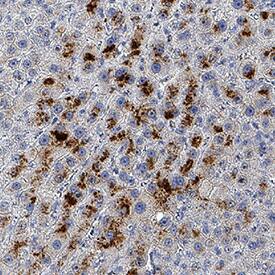 Ornithine Carbamoyltransferase/OTC was detected in immersion fixed paraffin-embedded sections of human liver using Mouse Anti-Human Ornithine Carbamoyltransferase/OTC Monoclonal Antibody (Catalog # MAB9918) at 5 µg/mL for 1 hour at room temperature followed by incubation with the Anti-Mouse IgG VisUCyte™ HRP Polymer Antibody (Catalog # VC001). Tissue was stained using DAB (brown) and counterstained with hematoxylin (blue). Specific staining was localized to cytoplasm in hepatocytes. View our protocol for IHC Staining with VisUCyte HRP Polymer Detection Reagents.