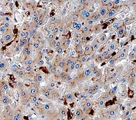 Osteoactivin/GPNMB was detected in immersion fixed paraffin-embedded sections of human liver using Goat Anti-Human Osteoactivin/GPNMB Antigen Affinity-purified Polyclonal Antibody (Catalog # AF2550) at 3 µg/mL overnight at 4 °C. Tissue was stained using the Anti-Goat HRP-DAB Cell & Tissue Staining Kit (brown; CTS008) and counterstained with hematoxylin (blue). Specific staining was localized to Kupffer cells. View our protocol for Chromogenic IHC Staining of Paraffin-embedded Tissue Sections.