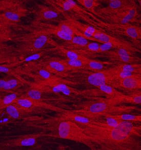 Osteoadherin/OSAD was detected in immersion fixed human mesenchymal stem cells differentiated into osteocytes using Mouse Anti-Human Osteoadherin/OSAD Monoclonal Antibody (Catalog # MAB2884) at 10 µg/mL for 3 hours at room temperature. Cells were stained using the NorthernLights™ 557-conjugated Anti-Mouse IgG Secondary Antibody (red; Catalog # NL007) and counterstained with DAPI (blue). Specific staining was localized to cytoplasm. View our protocol for Fluorescent ICC Staining of Stem Cells on Coverslips.