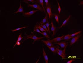 Osteocalcin was detected in immersion fixed MG-63 human osteosarcoma cell line using Mouse Anti-Human/Rat Osteocalcin Monoclonal Antibody (Catalog # MAB1419) at 10 µg/mL for 3 hours at room temperature. Cells were stained using the NorthernLights™ 557-conjugated Anti-Mouse IgG Secondary Antibody (red; Catalog # NL007) and counterstained with DAPI (blue). View our protocol for Fluorescent ICC Staining of Cells on Coverslips.