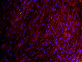 Immunocytochemistry Osteocalcin Antibody (190125)