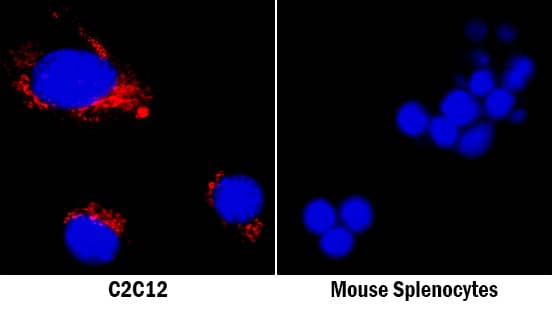 Osteopontin/OPN was detected in immersion fixed C2C12 mouse myoblast cell line (left panel, positive stain) and mouse splenocytes (right panel, negative stain) using Goat Anti-Mouse Osteopontin/OPN Antigen Affinity-purified Polyclonal Antibody (Catalog # AF808) at 5 µg/mL for 3 hours at room temperature. Cells were stained using the NorthernLights™ 557-conjugated Anti-Goat IgG Secondary Antibody (red; NL001) and counterstained with DAPI (blue). Specific staining was localized to cytoplasm and secreted molecule. View our protocol for Fluorescent ICC Staining of Cells on Coverslips.