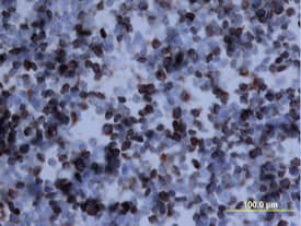 Osteopontin/OPN was detected in perfusion fixed frozen sections of mouse thymus using Mouse Osteopontin/OPN Antigen Affinity-purified Polyclonal Antibody (Catalog # AF808) at 15 µg/mL overnight at 4 °C. Tissue was stained using the Anti-Goat HRP-DAB Cell & Tissue Staining Kit (brown; CTS008) and counterstained with hematoxylin (blue). View our protocol for Chromogenic IHC Staining of Frozen Tissue Sections.