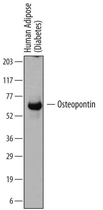 Western blot shows lysates of human adipose (diabetes) tissue. PVDF membrane was probed with 2 µg/mL of Mouse Anti-Human Osteopontin/OPN Monoclonal Antibody (Catalog # MAB14331) followed by HRP-conjugated Anti-Mouse IgG Secondary Antibody (Catalog # HAF007). A specific band was detected for Osteopontin/OPN at approximately 60 to 65 kDa (as indicated). This experiment was conducted under reducing conditions and using Immunoblot Buffer Group 1.