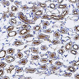 Osteopontin/OPN was detected in perfusion fixed frozen sections of mouse kidney using Rabbit Anti-Mouse Osteopontin/OPN Monoclonal Antibody (Catalog # MAB808) at 3 µg/mL for 1 hour at room temperature followed by incubation with the Anti-Rabbit IgG VisUCyte™ HRP Polymer Antibody (Catalog # VC003). Tissue was stained using DAB (brown) and counterstained with hematoxylin (blue). Specific staining was localized to convoluted tubules. View our protocol for IHC Staining with VisUCyte HRP Polymer Detection Reagents.