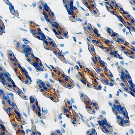 Osteoprotegerin/TNFRSF11B was detected in perfusion fixed frozen sections of mouse stomach using Goat Anti-Mouse Osteoprotegerin/TNFRSF11B Antigen Affinity-purified Polyclonal Antibody (Catalog # AF459) at 5 µg/mL overnight at 4 °C. Tissue was stained using the Anti-Goat HRP-DAB Cell & Tissue Staining Kit (brown; Catalog # CTS008) and counterstained with hematoxylin (blue). Specific staining was localized to glandular epithelial cells. View our protocol for Chromogenic IHC Staining of Frozen Tissue Sections.