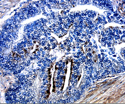 Osteoprotegerin/TNFRSF11B was detected in immersion fixed paraffin-embedded sections of human lymph node using 15 µg/mL Goat Anti-Human Osteoprotegerin/TNFRSF11B Antigen Affinity-purified Polyclonal Antibody (Catalog # AF805) overnight at 4 °C. Tissue was stained with the Anti-Goat HRP-DAB Cell & Tissue Staining Kit (brown; Catalog # CTS008) and counterstained with hematoxylin (blue). View our protocol for Chromogenic IHC Staining of Paraffin-embedded Tissue Sections.