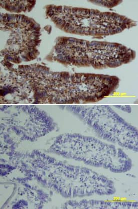 Osteoprotegerin/TNFRSF11B was detected in perfusion fixed frozen sections of mouse intestine using Goat Anti-Mouse Osteoprotegerin/TNFRSF11B Biotinylated Antigen Affinity-purified Polyclonal Antibody (Catalog # BAF459) at 15 µg/mL overnight at 4 °C. Tissue was stained using the Anti-Goat HRP-DAB Cell & Tissue Staining Kit (brown; Catalog # CTS008) and counterstained with hematoxylin (blue). Lower panel shows a lack of labeling if primary antibodies are omitted and tissue is stained only with secondary antibody followed by incubation with detection reagents. View our protocol for Chromogenic IHC Staining of Frozen Tissue Sections.