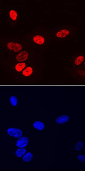 Immunocytochemistry Osterix/Sp7 Antibody (764704)