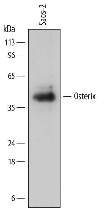 Western Blot Osterix/Sp7 Antibody (764704)