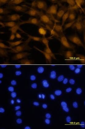 Otx2 was detected in immersion fixed NTera-2 human testicular embryonic carcinoma cell line using Goat Anti-Human Otx2 Antigen Affinity-purified Polyclonal Antibody (Catalog # AF1979) at 10 µg/mL for 3 hours at room temperature. Cells were stained using the NorthernLights™ 557-conjugated Anti-Goat IgG Secondary Antibody (yellow, upper panel; Catalog # NL001) and counterstained with DAPI (blue, lower panel). View our protocol for Fluorescent ICC Staining of Cells on Coverslips.