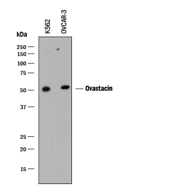 Western Blot Ovastacin Antibody [Unconjugated]