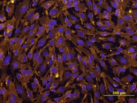 E-Selectin (CD62E)/P-Selectin (CD62P) was detected in immersion fixed HUVEC human umbilical vein endothelial cells stimulated with TNF-alpha (Catalog # 210-TA-010) using Mouse Anti-Human E-Selectin (CD62E)/P-Selectin (CD62P) Monoclonal Antibody (Catalog # BBA1) at 10 µg/mL for 3 hours at room temperature. Cells were stained using the Northern-Lights™ 557-conjugated Anti-Mouse IgG Secondary Antibody (yellow; Catalog # NL007) and counterstained with DAPI (blue). View our protocol for Fluorescent ICC Staining of Cells on Coverslips.