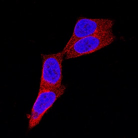 P2X7/P2RX7 was detected in immersion fixed WM-115 human malignant melanoma cell line using Mouse Anti-Human P2X7/P2RX7 Monoclonal Antibody (Catalog # MAB9790) at 8 µg/mL for 3 hours at room temperature. Cells were stained using the NorthernLights™ 557-conjugated Anti-Mouse IgG Secondary Antibody (red; Catalog # NL007) and counterstained with DAPI (blue). Specific staining was localized to cytoplasm. View our protocol for Fluorescent ICC Staining of Cells on Coverslips.