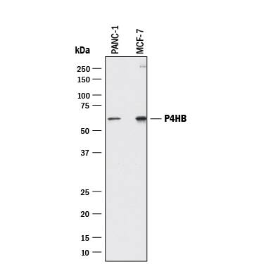 Western blot shows lysates of PANC-1 human pancreatic carcinoma cell line and MCF-7 human breast cancer cell line. PVDF membrane was probed with 1 µg/mL of Goat Anti-Human Protein Disulfide Isomerase/ P4HB Antigen Affinity-purified Polyclonal Antibody (Catalog # AF4236) followed by HRP-conjugated Anti-Goat IgG Secondary Antibody (Catalog # HAF017). A specific band was detected for Protein Disulfide Isomerase/P4HB at approximately 57 kDa (as indicated). This experiment was conducted under reducing conditions and using Immunoblot Buffer Group 1.
