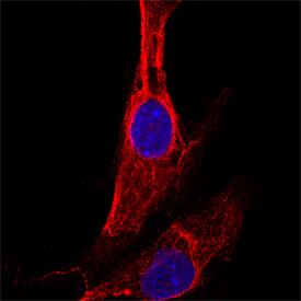 Protein Disulfide Isomerase/P4HB was detected in immersion fixed HeLa human cervical epithelial carcinoma cell line using Mouse Anti-Human Protein Disulfide Isomerase/P4HB Monoclonal Antibody (Catalog # MAB4236) at 25 µg/mL for 3 hours at room temperature. Cells were stained using the Northern-Lights™ 557-conjugated Anti-Mouse IgG Secondary Antibody (red; Catalog # NL007) and counterstained with DAPI (blue). Specific staining was localized to cytoplasm. View our protocol for Fluorescent ICC Staining of Cells on Coverslips.