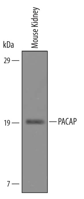 Western Blot PACAP/ADCYAP1 Antibody [Unconjugated]