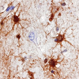 Immunohistochemistry PADI2 Antibody