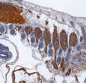 Immunohistochemistry PAK3 Antibody [Unconjugated]
