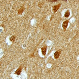 Immunohistochemistry PAK3 Antibody [Unconjugated]
