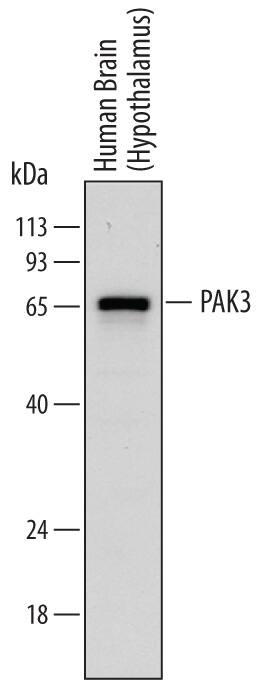 Western blot shows lysates of human brain (hypothalamus) tissue. PVDF membrane was probed with 0.25 µg/mL of Sheep Anti-Human PAK3 Antigen Affinity-purified Polyclonal Antibody (Catalog # AF6897) followed by HRP-conjugated Anti-Sheep IgG Secondary Antibody (Catalog # HAF016). A specific band was detected for PAK3 at approximately 65 kDa (as indicated). This experiment was conducted under reducing conditions and using Immunoblot Buffer Group 1.